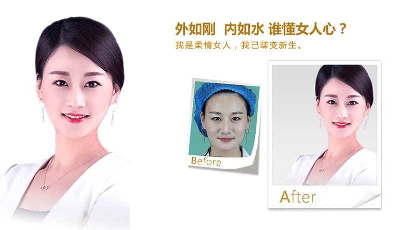 北京V脸、线雕隆鼻